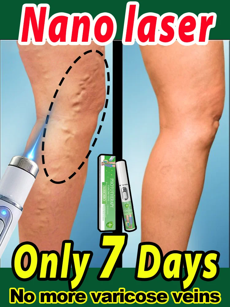 

Blue Laser Heals Leg Veins