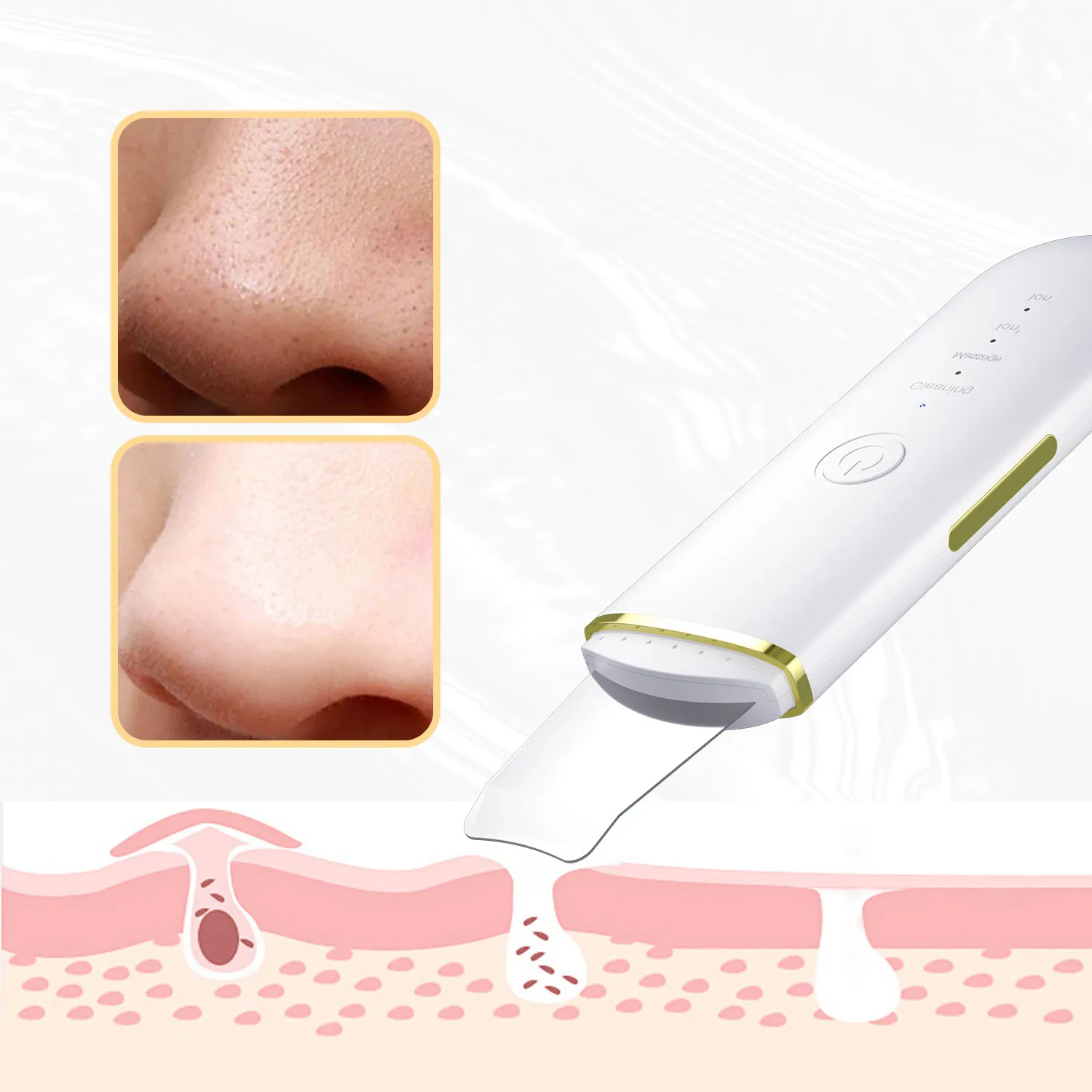 振動式フェイシャルスクレーパー、黒ずみ除去スパチュラ、超音波スキンクリーナー、クリーニングキャビテーション角質除去、リフティングフェイシャルスキン