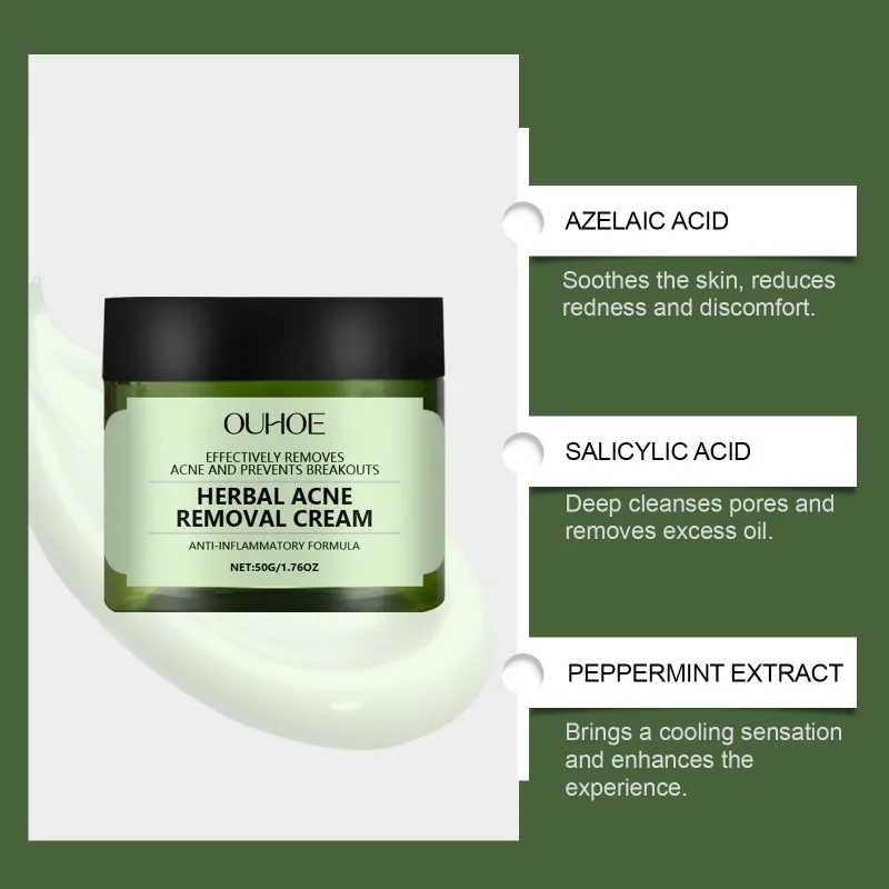 Crema para eliminar el acné a base de hierbas, elimina puntos negros cachondos, reduce los poros, Reduce las imperfecciones, Control de aceite antiinflamatorio, suero para el cuidado Facial