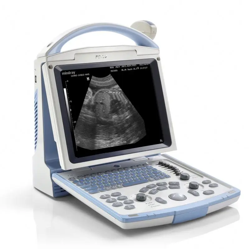 

Mindray Dp-20 Ultrasound Machine Portable Color Doppler Ultrasound System