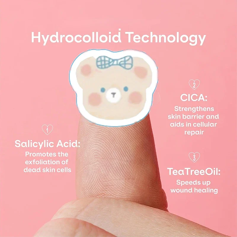 100 قطعة من رقعة بثرة حب الشباب للعناية بالبشرة والشفاء الاحترافي غير المرئي #5