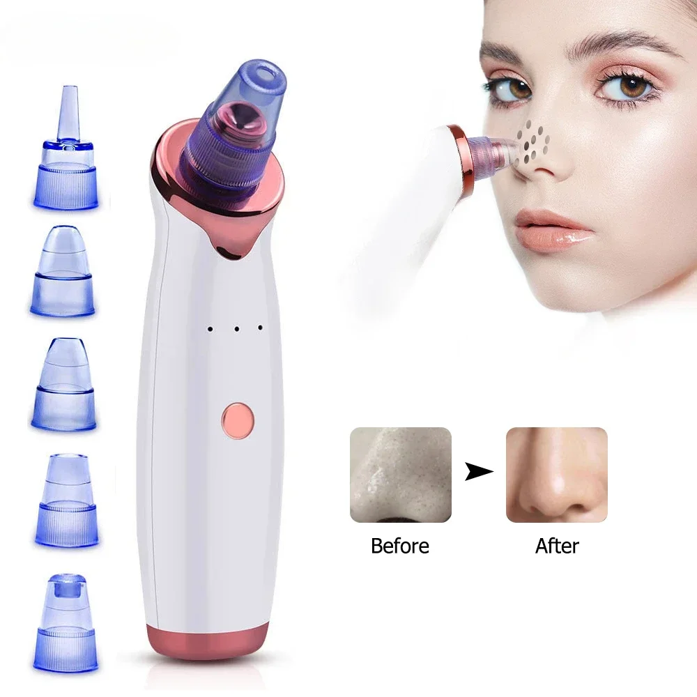 

Blackhead Remover Pore Vacuum Electric Beauty Nose Face Deep Cleansing Skin Care Whitehead Black Spots Acne Cleaner Pimple Tool