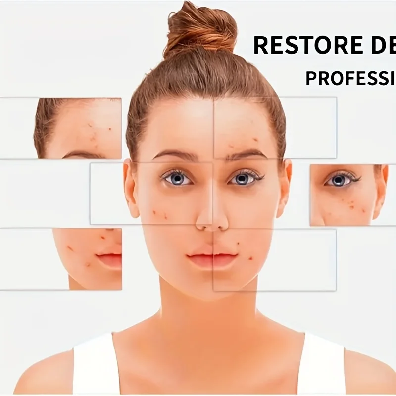 4ピースニキビ抽出セット、顔のニキビ、黒ずみ、ニキビを取り除くために使用され、肌を滑らかで柔らかくします。