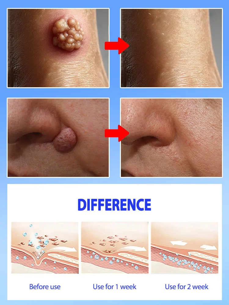 Profesjonalne rozwiązanie na problemy z skórą