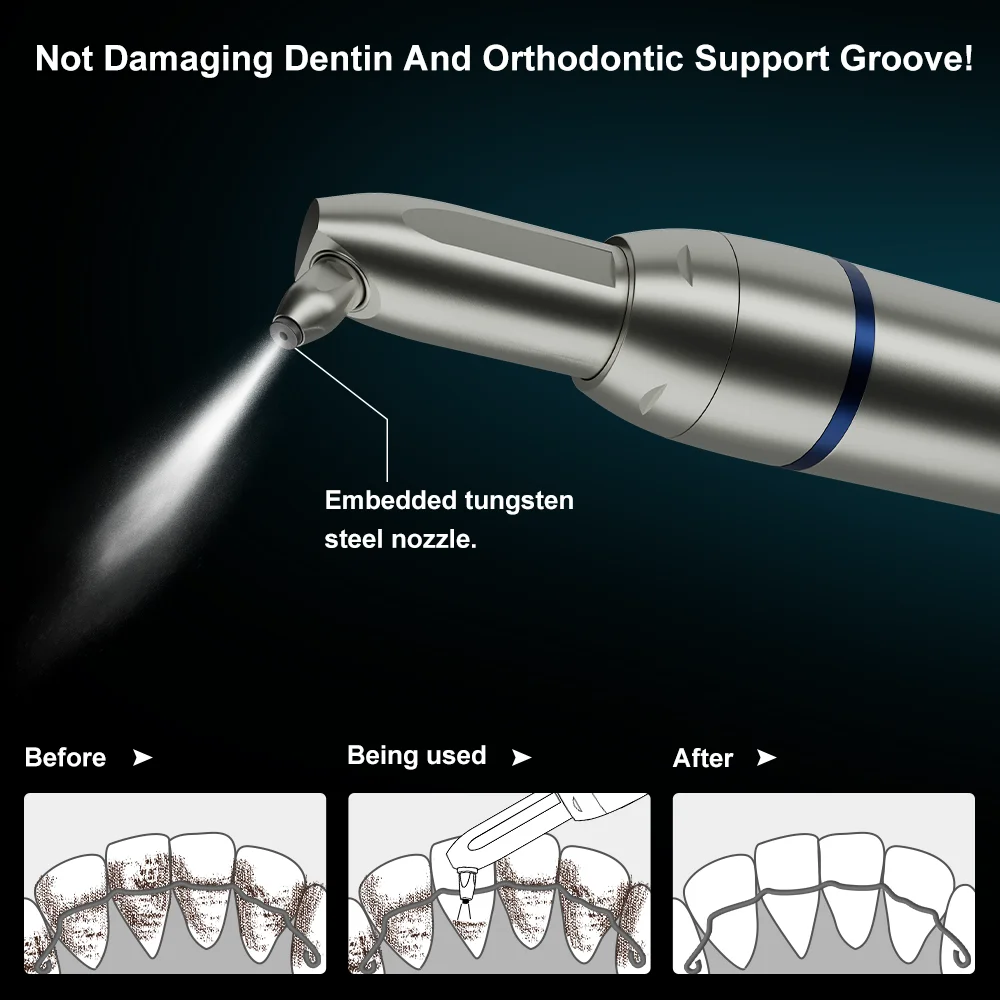 Polvere di allumina dentale Air abrasione Blaster Micro sabbiatura all'ossido di alluminio con spruzzo d'acqua interno lucidatura ad aria orale AI-AP2