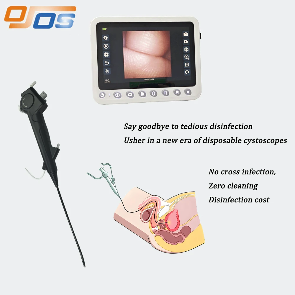 Flexible USB Output Digital Flexible Cystoscope HD Resolution 1280*720 Customized Cable Length Waterproof IPX8 for Vet Market