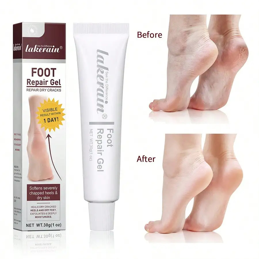 Repairing Foot Crack Cream Deep Moisturizing Treatment for Dry Cracked Skin and Exfoliation view 2