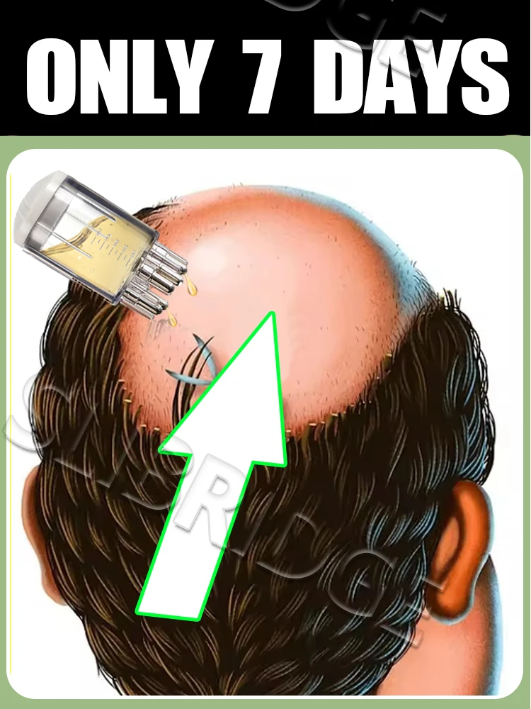 

2025Scalp Applicator Liquid Comb for Hair Scalp Treatment,Liquid-filled device for Abundant Hair, Hair Growth Serum Oil Apply