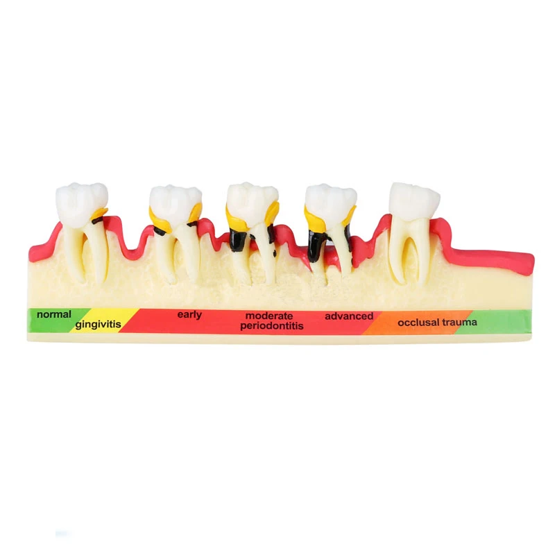 

Dental Teeth Model Periodontal Disease Assort Tooth Classification Model 1PC