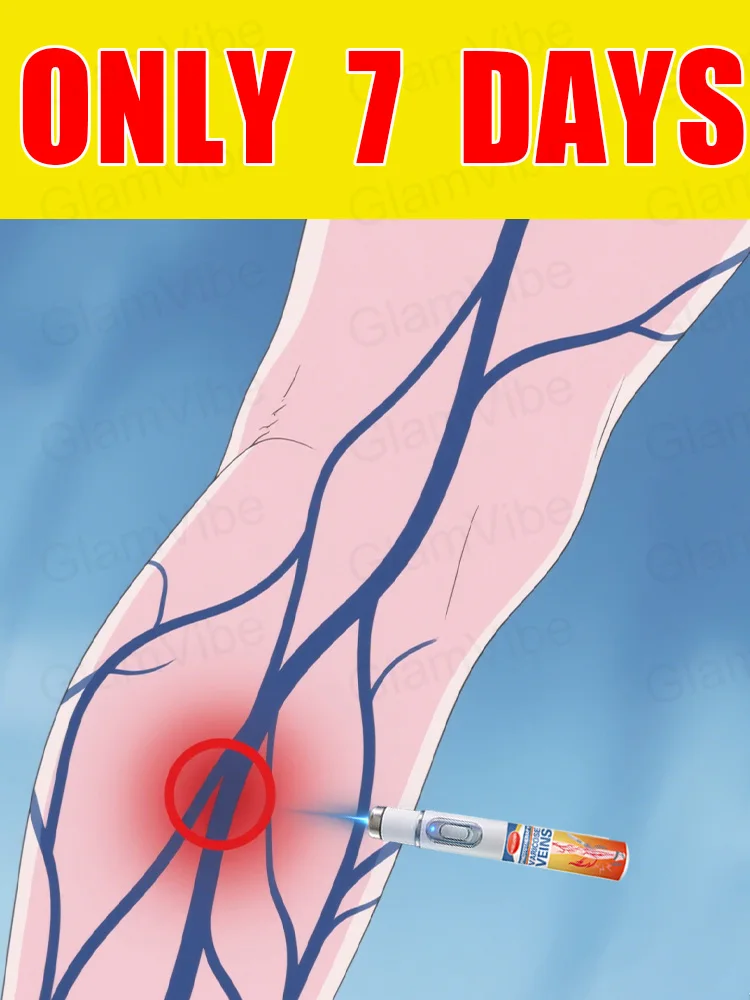 

Generation-2 Laser Says Goodbye To Spider Legs Varicose In 7 Days
