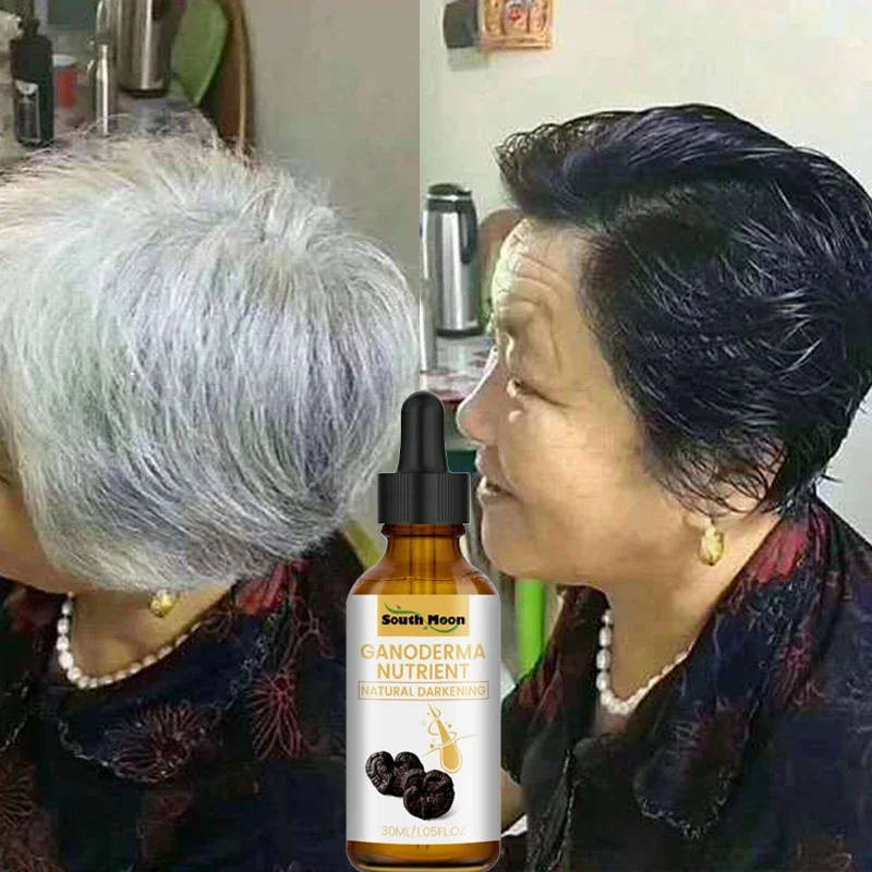 Gray White Hair Treatment Serum Oil White To Black Permanent Treatment Natural Color Repair Anti Loss Product Care For Men Women