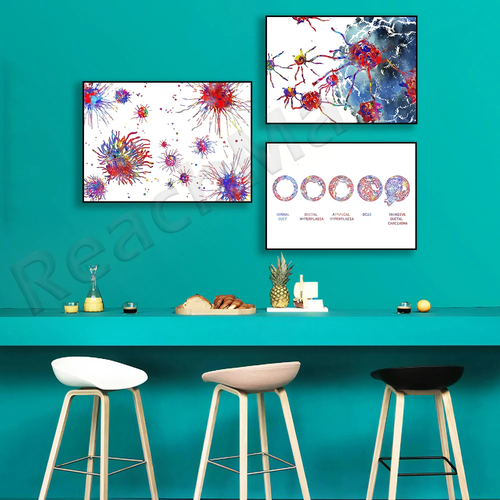 Cancer cells, prostate cancer cells, normal breast cancer and breast cancer types anatomy breast biology art poster, medical gif