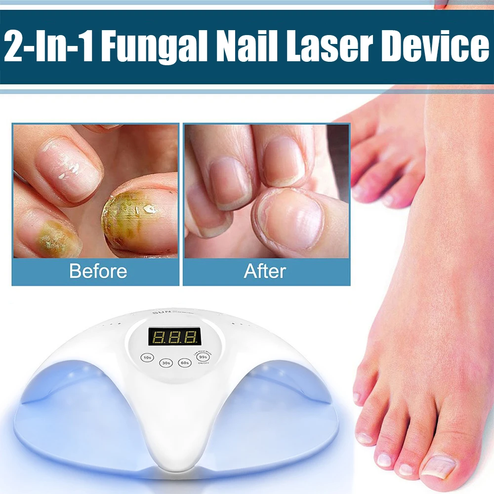 Anti-Fungal Skin Laser Device Hand Foot Skin Repair Herbal Ointment Nail Fungus Removal Anti-Infection Paronychia Skin Care Tool