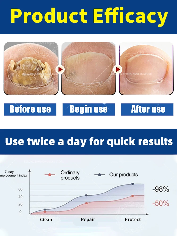 manicure voor slecht Kan in 7-dagen afscheid Geschikt voor alle leeftijden