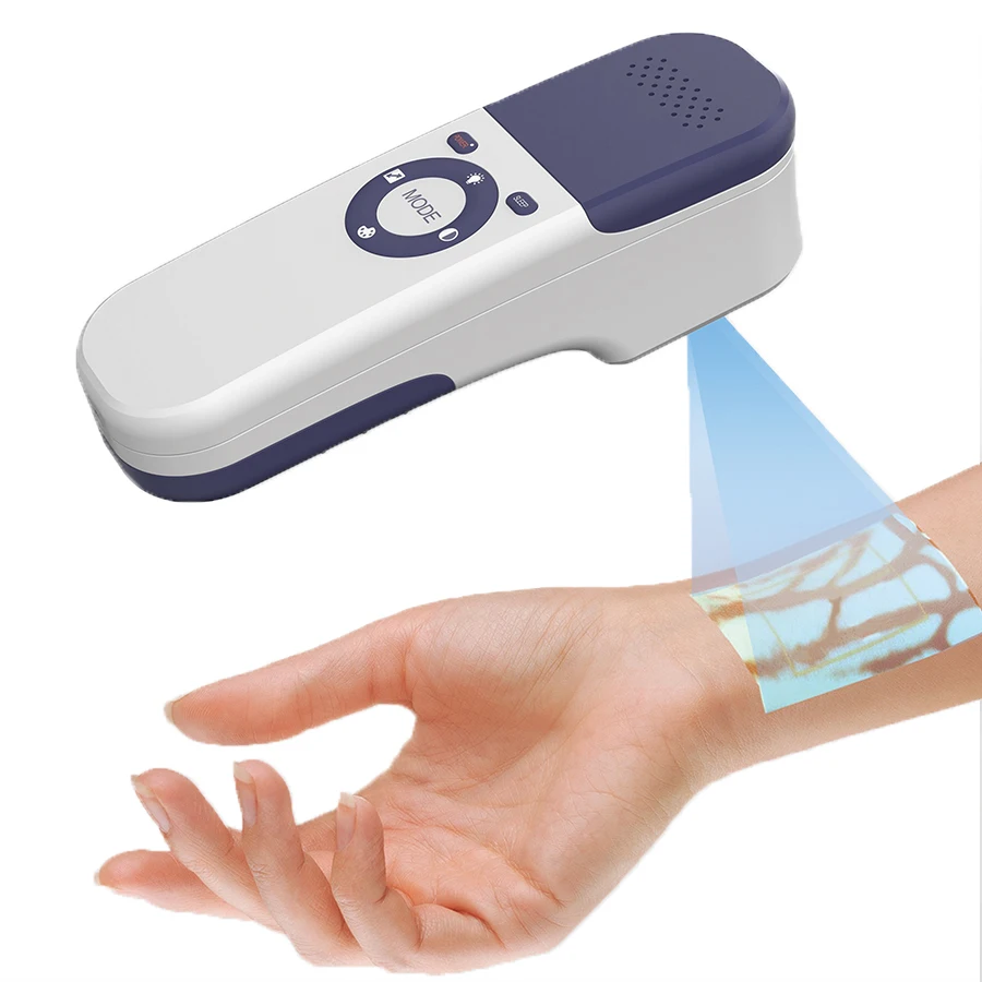 Hot Sale LM-500 Vein Finder CE Adult Infrared Light Medical Vein Finder Portable with Good Price