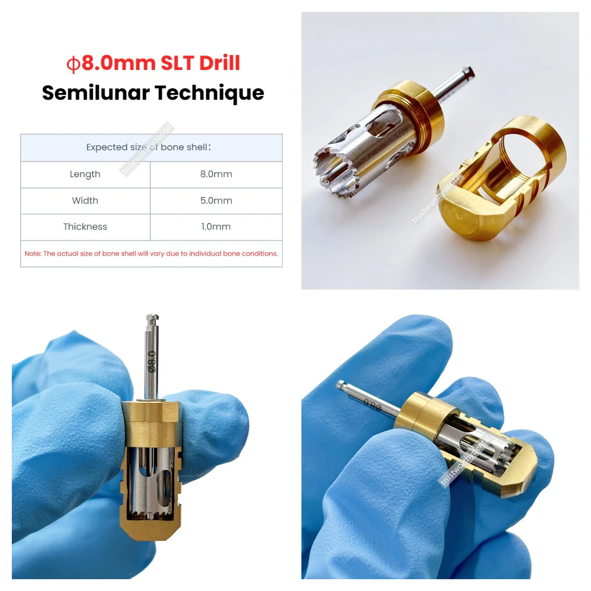 3 حجم الأسنان SLT كتل العظام الحصاد الحفر GBR تقنية Semilunar زرع العظام جامع نصف القمر الحصاد الحفر الأكمام المعدنية