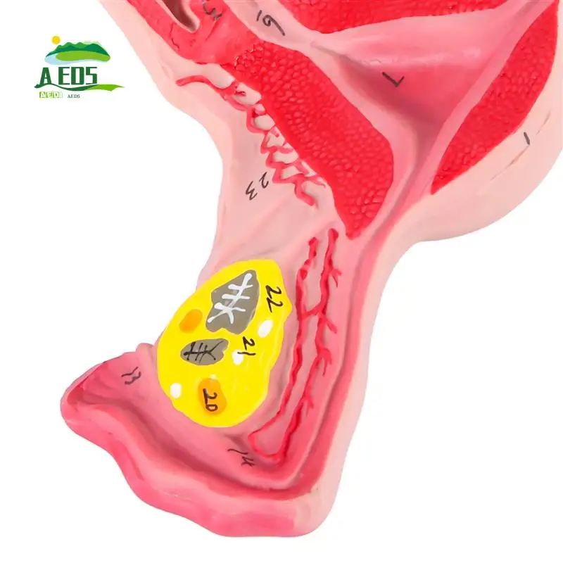 

AED5-1:1 Human Female Uterus Ovary Fallopian Tubes Model Anatomical Human Anatomy Model Teaching Tools