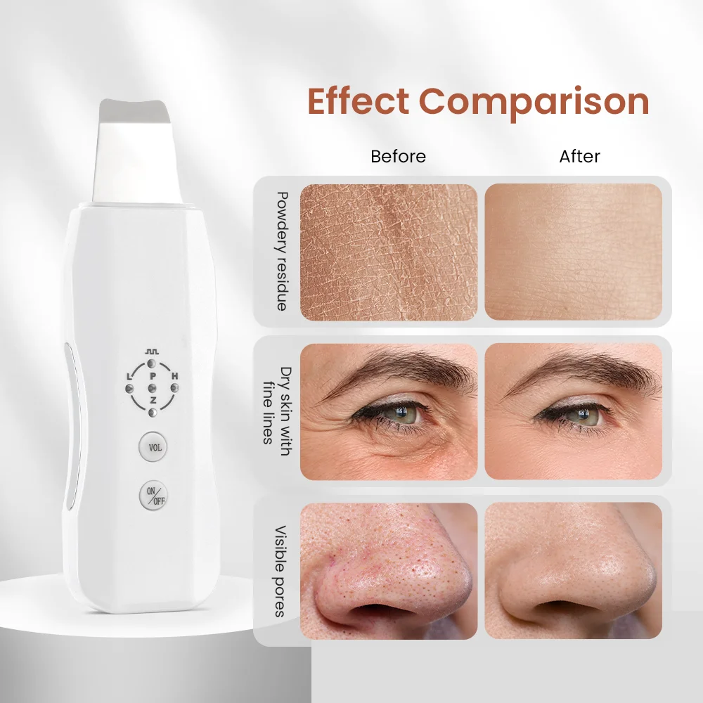 facial ultrasonic cleaner  Deeply clean skin Blackhead Remover Remove dead skin skincare equipment ﻿