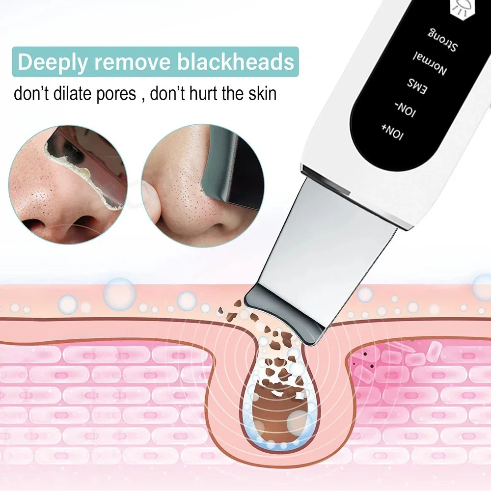 New ultrasonic skin scraper, household pore cleaner, colored light EMS blackhead shovel beauty