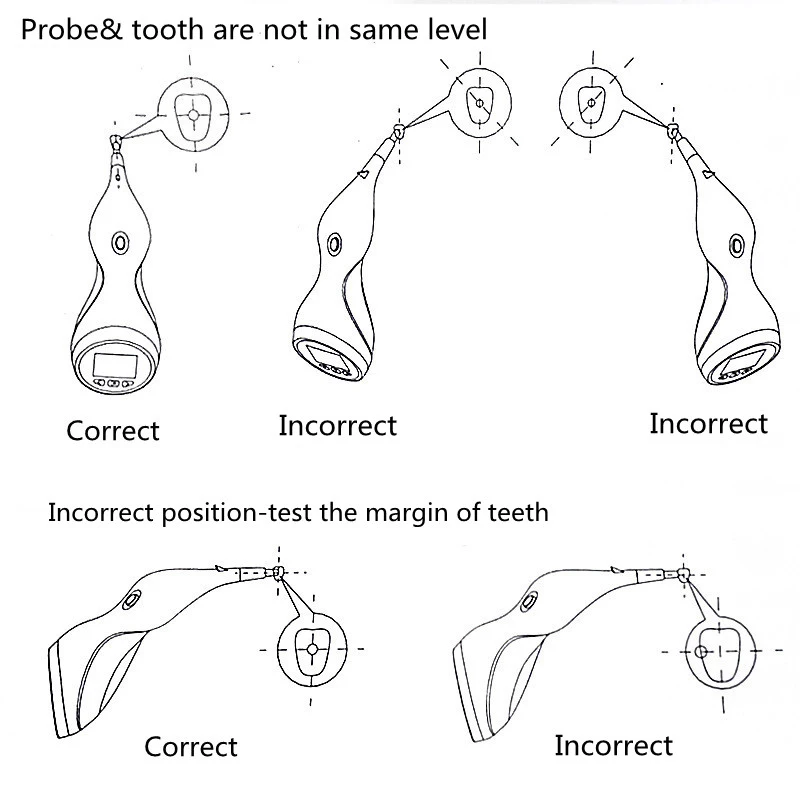 Dental Teeth Whitening Digital Shade Guide LED Tooth Color Comparator