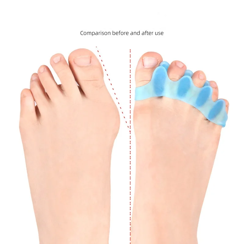 Immagine 4: Cuscinetti per l'avampiede Dispositivi per alluce valgo Divisori per dita a cinque fori Separatori per dita per la cura delle dita sovrapposte delle dita