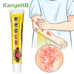 1Pcs Psoriasis Cream Antibacterial Herbal Plaster Dermatitis Eczematoid Eczema Ointment Treatment Psoriasis Skin Care Cream S050