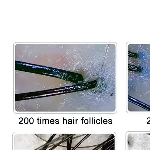 Professional all-in-one scalp 10-inch display microscope hair analyzer device HD skin high-frequency hair detector scalp massage