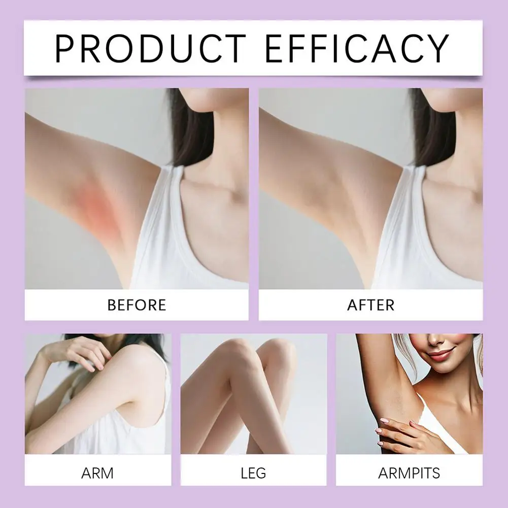 Cyperus Rotundus Skin Serum Hair Growth Inhibitor Natural Soothing Moisturizing Shink Pores Body Hair Removal Essence Liquid