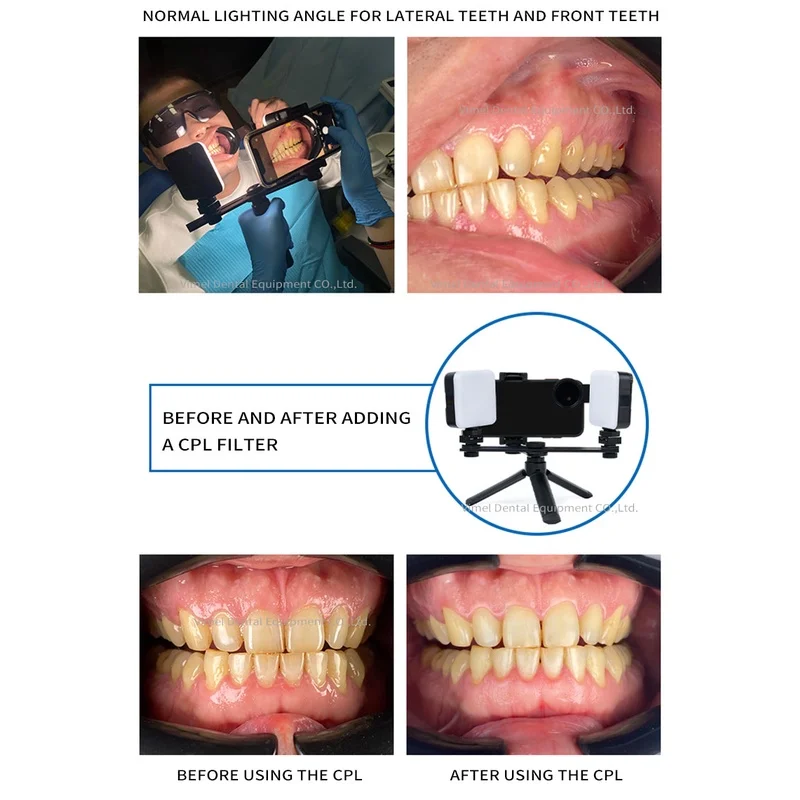 Dental equipment mouth shooting mobile phone fill light portable tripod  small intelligent colorimetric lamp LED oral photograph