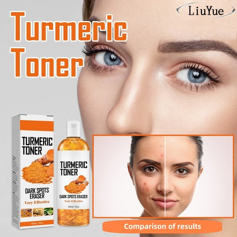 Tóner que ilumina la piel, elimina las pecas, aclara el Melasma, pigmentación, desvanece las manchas oscuras, hidratante, tóner facial de cúrcuma