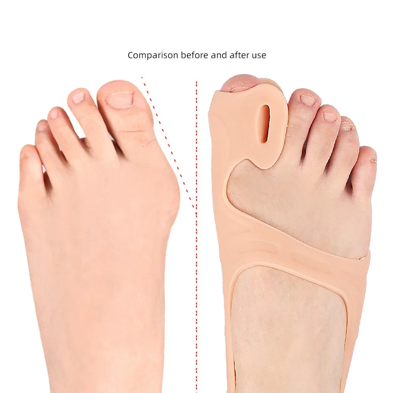 1Pcs Soft Gel Big Toe Separator Wear-resistant Sleeve Hallux Valgus Fingers Foot Care Tension Strap For Day And Night Use