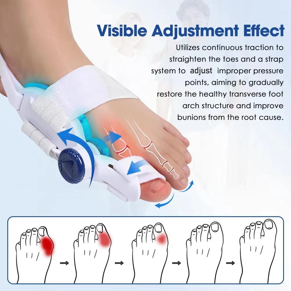 Cooling Pad  Toe Splint Bunion Adjuster Adjustable Big Toe Valgus Support Tool for Both Feet Straightening Orthopedic Thumb - view 3