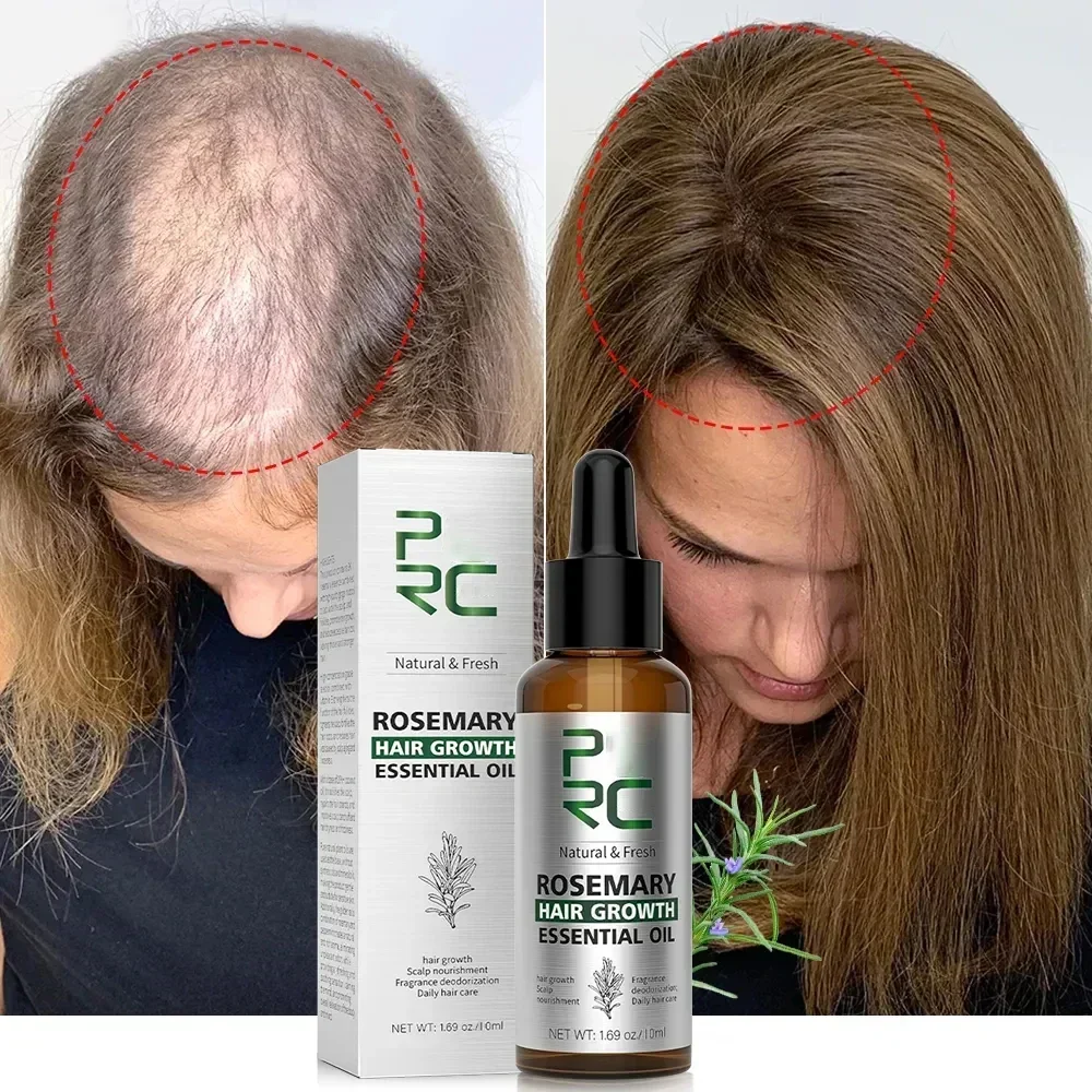 Produtos De Crescimento Rápido Óleos Essenciais, Ginger Anti Hair Loss Scalp Tratamento, Cuidado do cabelo