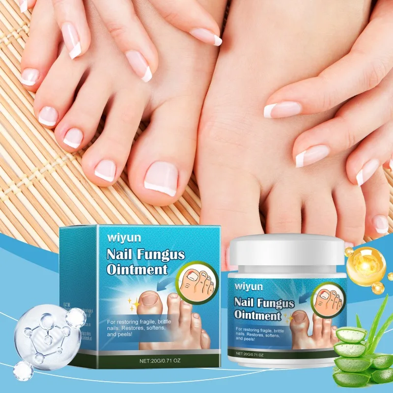 Ungüento de hongos para uñas, crema suave para el cuidado nutritivo y calmante para las uñas de los pies