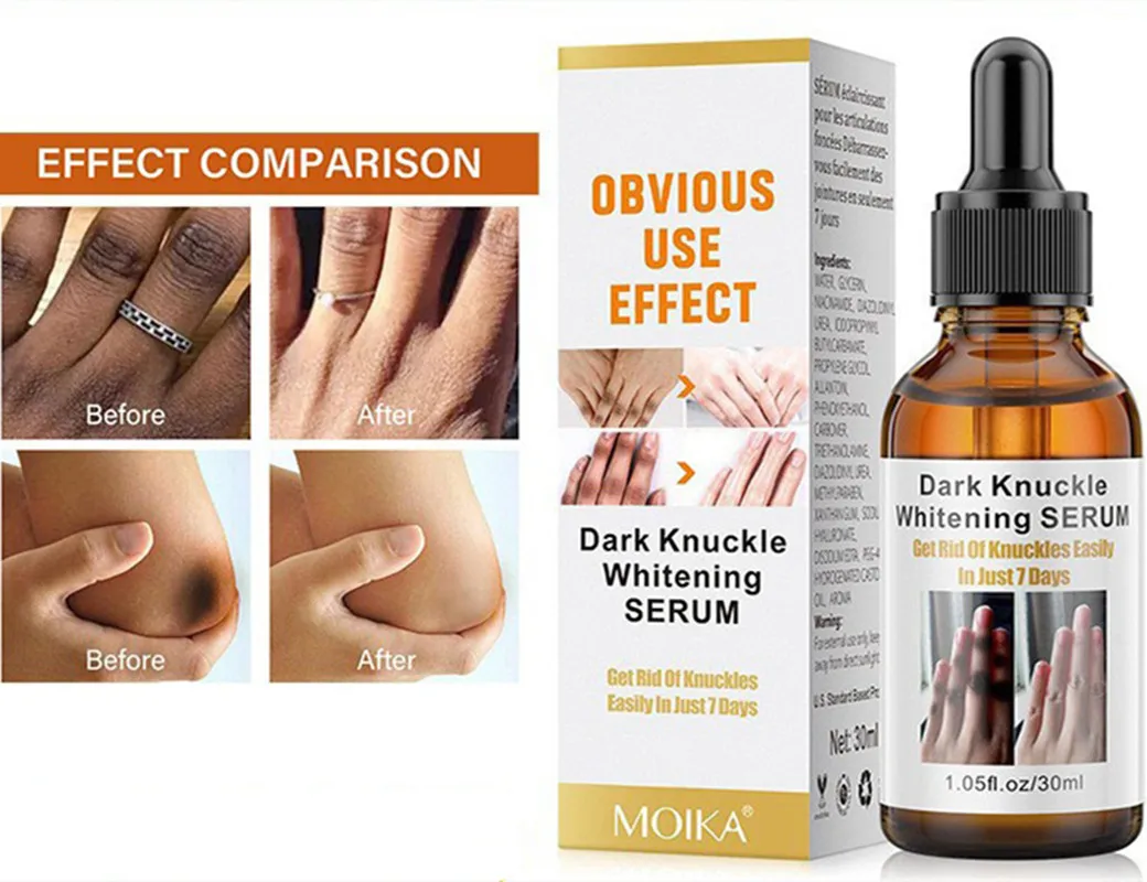 Dark Knuckle Whitening SERUM Joint Blackening essence Knee Ankle Brightening Skin Tone Lightening Spot Original Solution