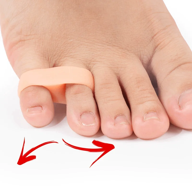 

1/2/6Pair Toe Corrector Silicone Feet Care Straightener Overlapping Separator Protector Hallux Valgus Bunions Pain Relieve
