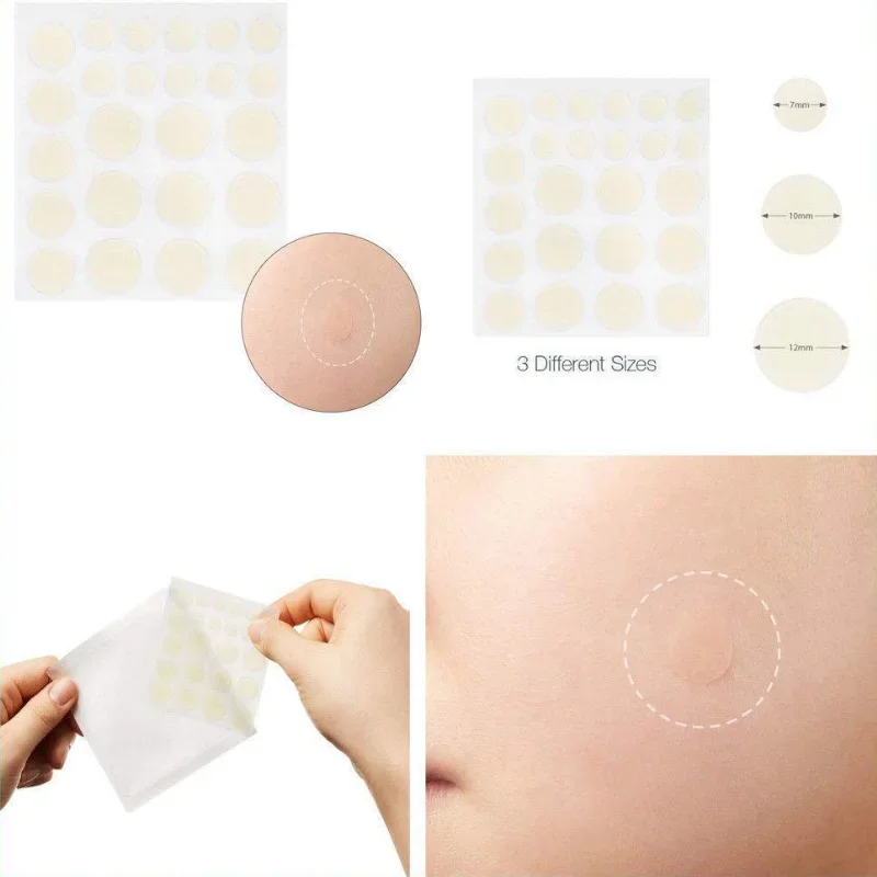 Face Acne Pimple Spot Scar Care Treatment Stickers Facial Skin Care Blackhead Removal Freckle Patches 24pcs/48pcs/72pcs