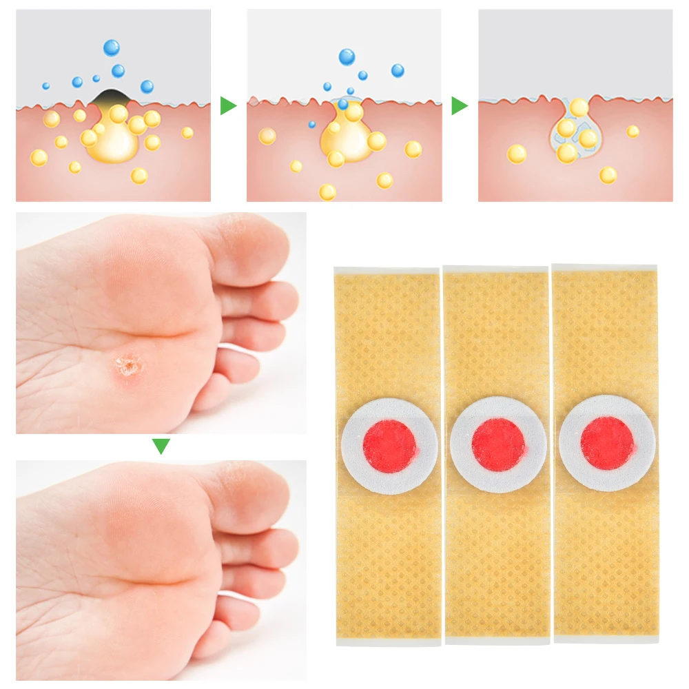 42/84pcs Corn Patch Corn Plaster Remover Corn Toe Pads Patch Adhesive Callus Cushion Non-woven Fabric Toe Corn Callus Removal