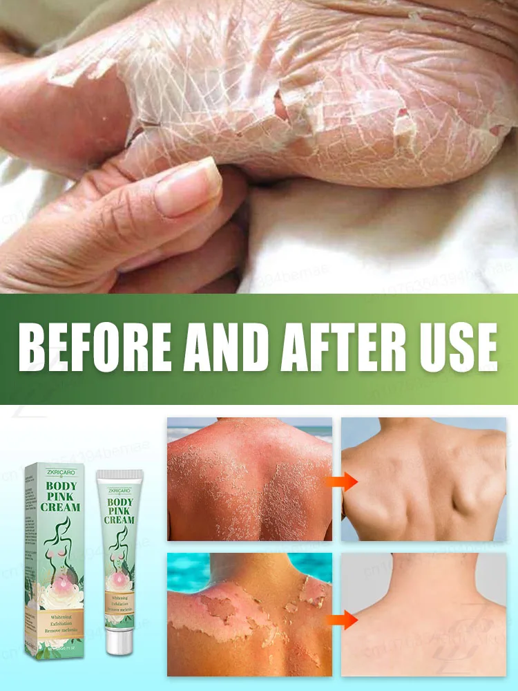 مجرد لمسة خفيفة يمكنها إزالة الميلانين وجعل بشرةك أكثر بياضًا