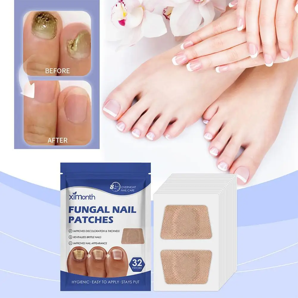 

32pc/bag Paronychia Treatment Patch Fungus Removal Nail Correction Stickers Ingrown Nails Recover Pedicure Tools Repair Patches