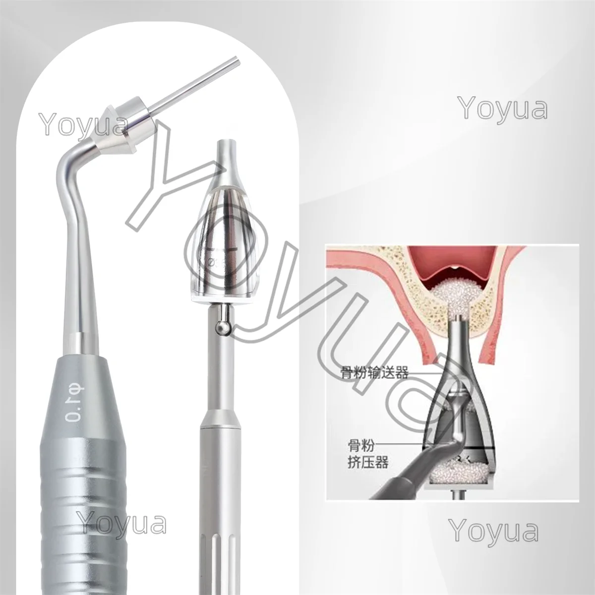 1 مجموعة زراعة الأسنان الفكري الجيوب الأنفية رفع أداة صندوق كريستال نهج الجيوب الأنفية عدة طبيب الأسنان زرع الأدوات الجراحية أدوات #5