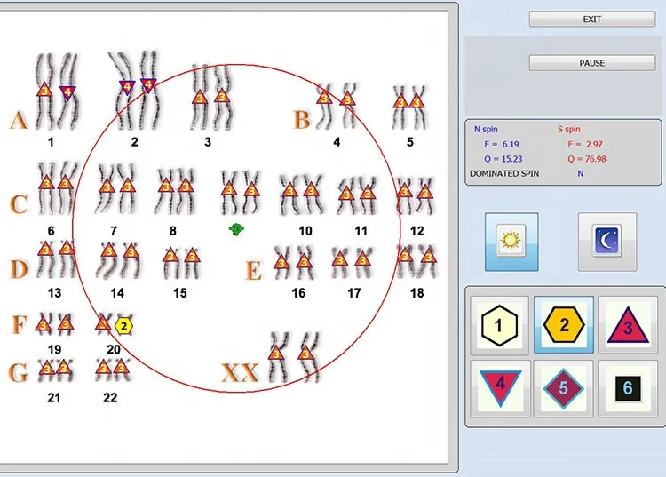 2023 New Aura Therapy NLS Bioresonance Acupuncture Iris Aura DNA RNA 12d Nls Diagnostics Device