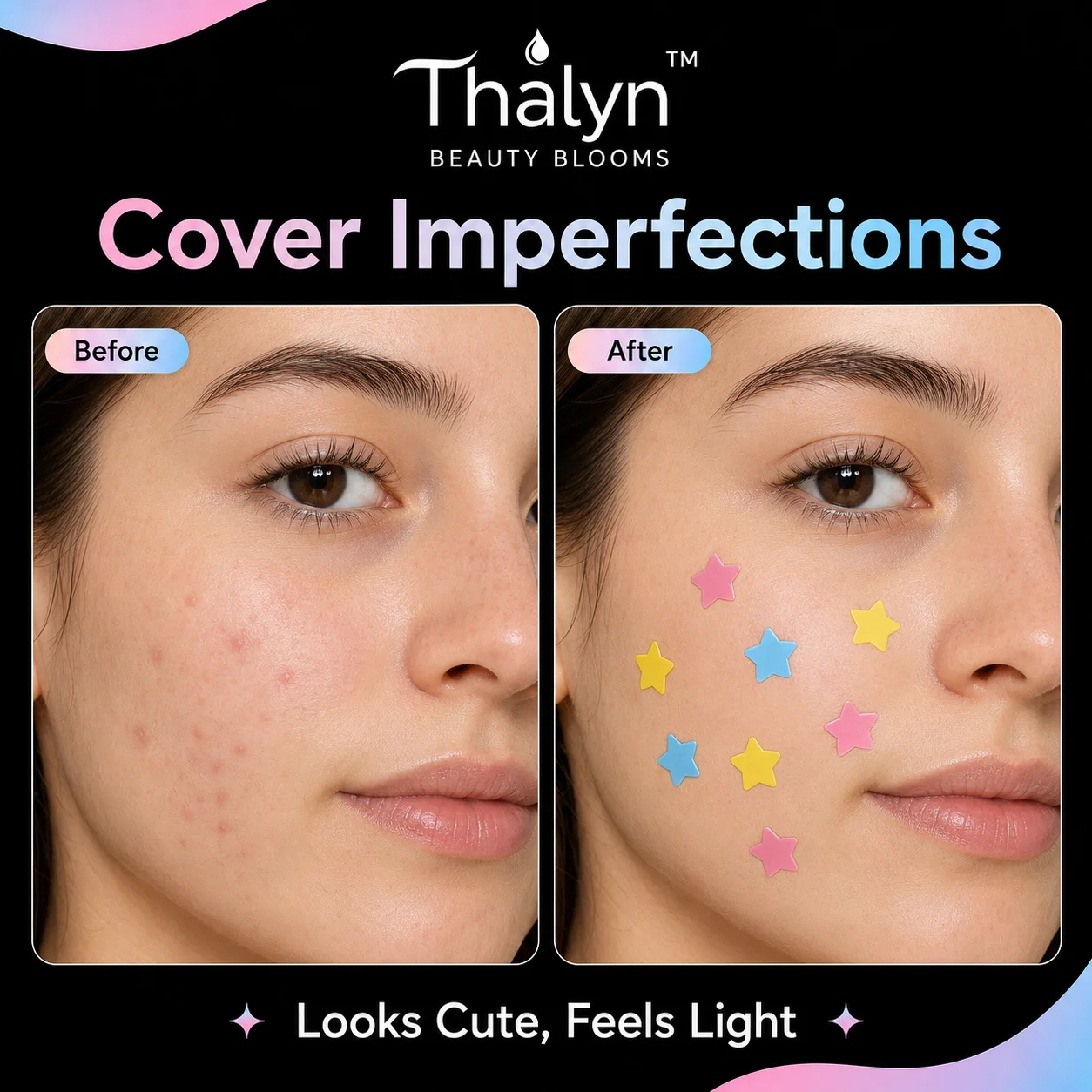 360PCS Colorful Star Pimple Patches Yellow Blue Pink Acne Patch Invisible Makeup Skin Cover Sticker Cute Beauty Patch - view 5