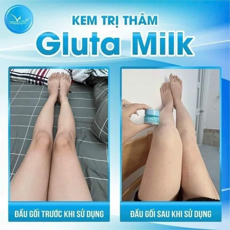 Kem tri tham nach GLUTA LOTE, 15 g de exfoliante profundo Kem, + 10 ml, para reducir el olor a mancha negra, blanco en las axilas
