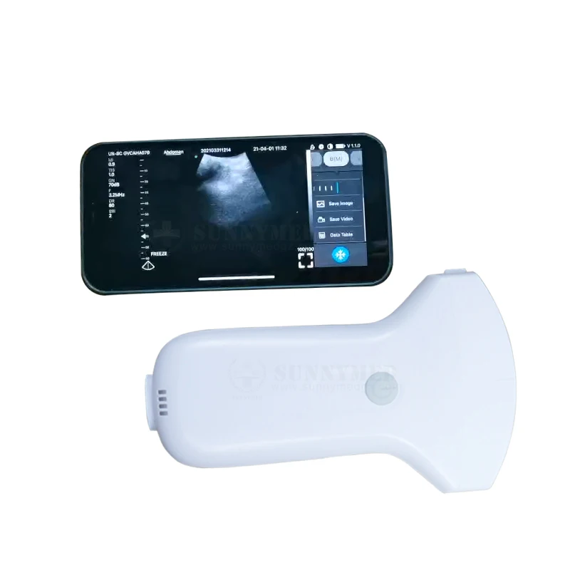 SY-A052C  Wifi Portable Color Doppler Handheld Mini Wireless Ultrasound Scanner  192 element 3 in 1 wireless ultrasound scanner