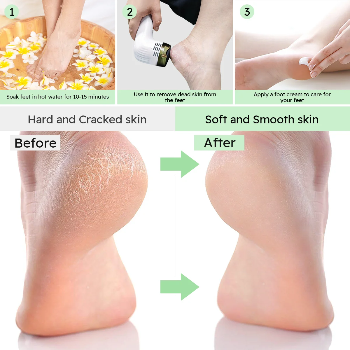 Thumbnail 3 - #24 Best Electronic Foot Files to Buy In 2026