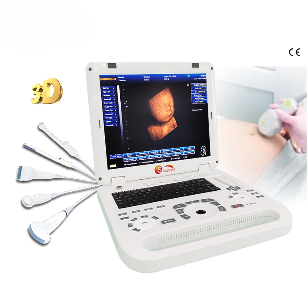 Sunbright best price sale 3D laptop 15 Inch PC-based ultrasound device for sale