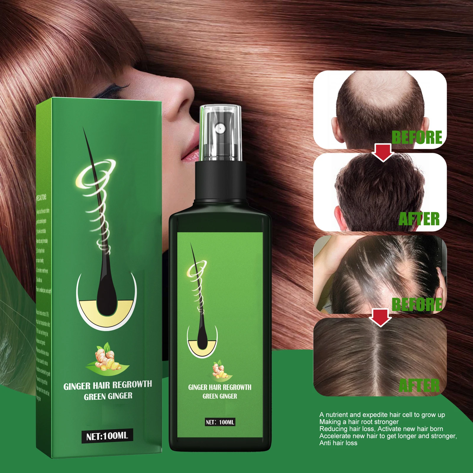 Anti Hair Loss essence Hair Growth spray Ginger Massage Scalp Damage Treatment Solution Nourishing Root Rapid Growth