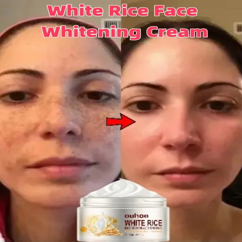 

White Rice Face Whitening Cream Remove Dark Spots Fade Freckle Melanin Anti Wrinkle Aging Moisturizing Brighten Skin Care New