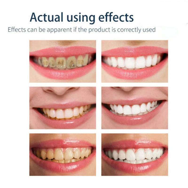 2025 New Tooth-Cleaning Press Type Mousse,Foam Toothpaste,Fresh Shining,Stain-Removing,Fresh-Breathing,Oral Hygiene Health Care